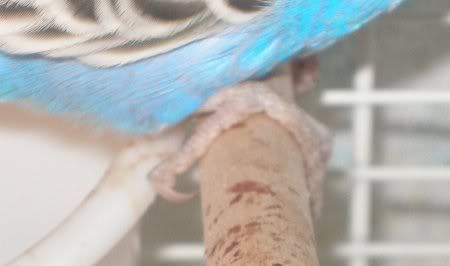 kim_nomral_toes.jpg