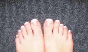Thick Ugly Toenails